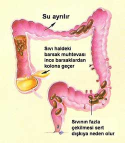 ruyada kabiz olmak ne anlama gelir